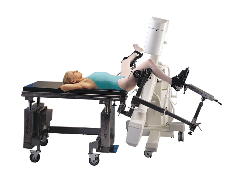 tibia-nailing-ap-view-ortho Sai Surgicals